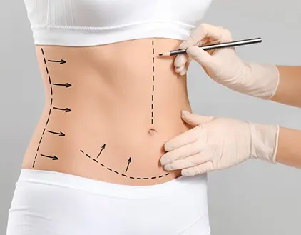 Body Contouring and Tightening Treatment in Gurgaon