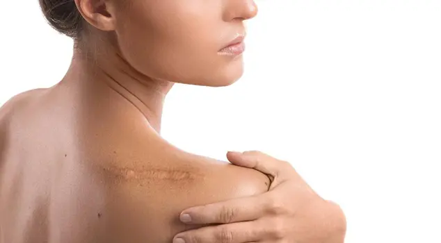 Best Skin Rejuvenation Treatment in Gurgaon, Delhi